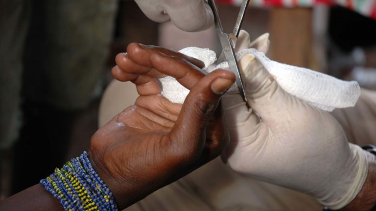 wound care in Africa